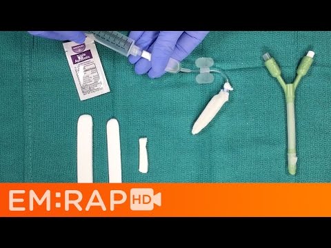 Epistaxis Management