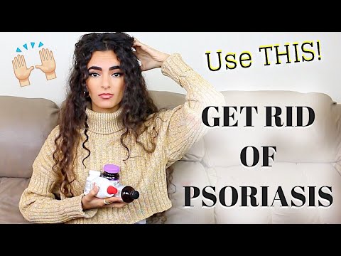 Skin cap spray for psoriasis reviews