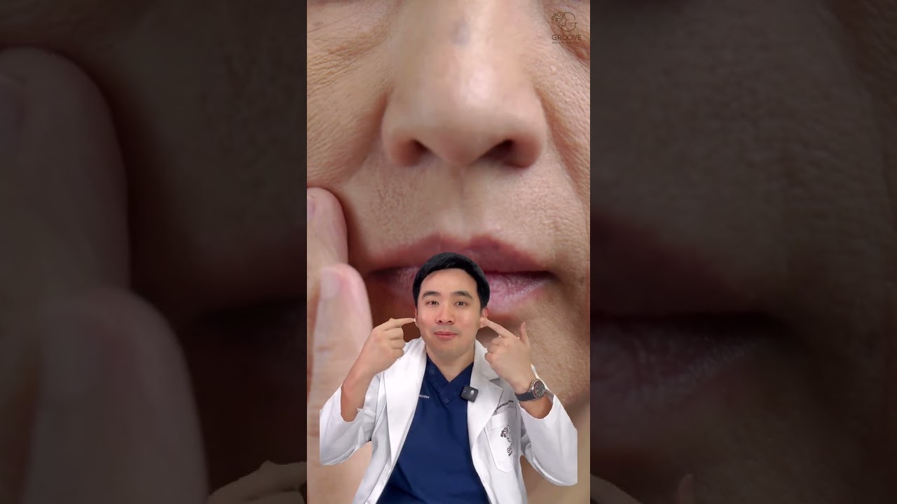 รีวิวปรับรูปหน้า