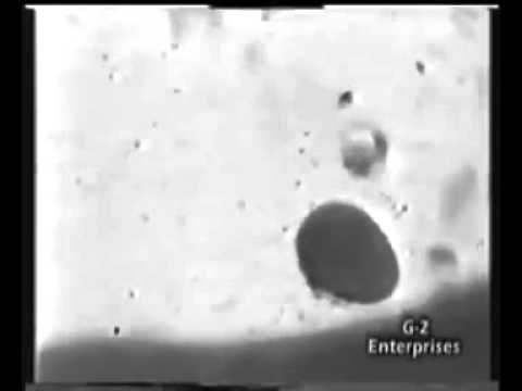 Deta Elis device Killing Parasites