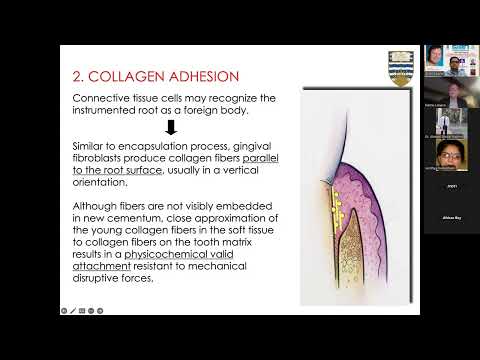 L11 Periodontal wound healing and regeneration