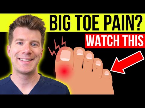 Why does my big toe hurt? 9 reasons for BIG TOE PAIN | Bunions, Gout, Arthritis, Infection and more!