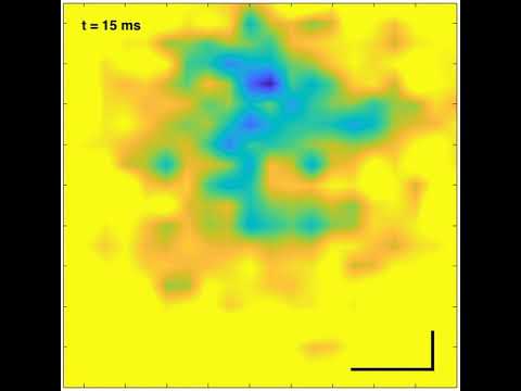 A graphene ‘camera’ and your beating heart: say cheese