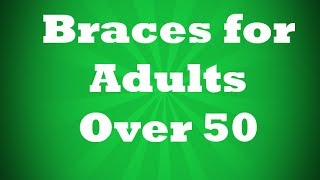 preview picture of video 'Braces for Adults Over 50 - Dr. Randy L. Gittess - Winter Springs'