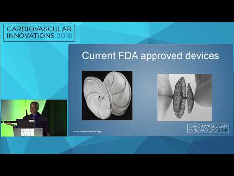 CVI2018 Session: What's missing in occluder therapy? - Srinivas Iyengar, MD