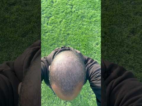 Spartan root activator shampoo, and conditioner. 5 months update!! It has made a difference for me!