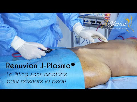 Renuvion J Plasma associé à une liposuccion et une réduction mammaire