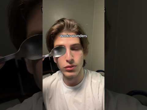 An iced spoon to relieve eye bags? What could go wrong?