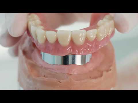 Zubna proteza na implantatima: rješenje za bezube čeljusti | CENTRODENT -dentalna medicina