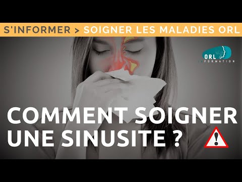 Comment soigner une sinusite? | Maladie, symptômes et traitement