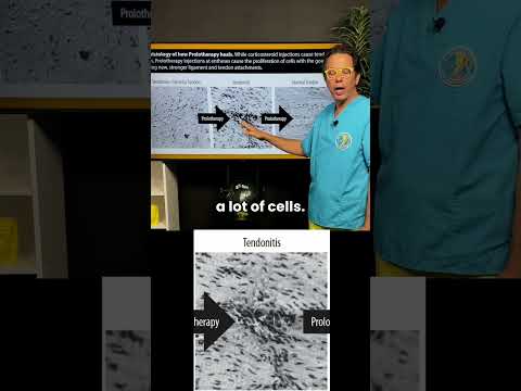 Prolotherapy causes temporary inflammation #inflammatory #tendonitis #ligament #regenerativetherapy
