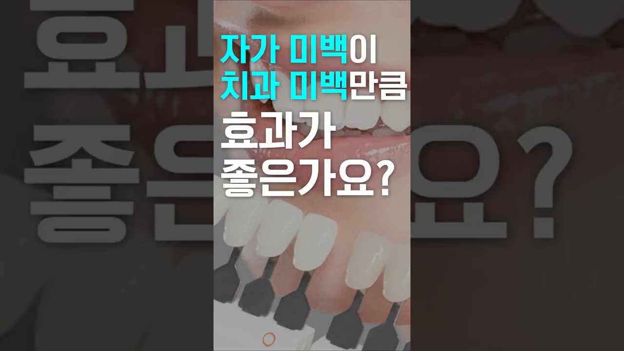 집에서 하는 미백보다 치과에서 하는 미백이 좋은이유