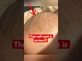 Why You Shouldn’t Touch a Baby’s Skull