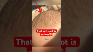 Why You Shouldn’t Touch a Baby’s Skull