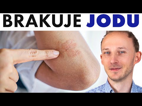 Tak ciało ostrzega, że brakuje Ci JODU + jak cofnąć niedobór