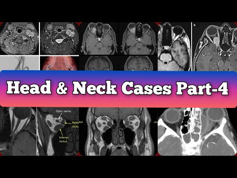 Radiology Viva Cases # 393-398 | Head and Neck Exam Cases Part -4  #medical #radiology