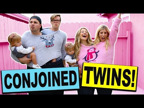 Conjoined Twins Dance Battle Challenge with Real Twin Babies  (Boys vs Girls) *Most Adorable*