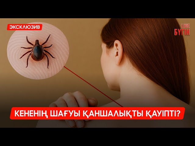 Кене шаққанда не істеу керек? Инфекционист кеңесі