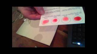 How to find out your blood type - Rhesus negative or positive?