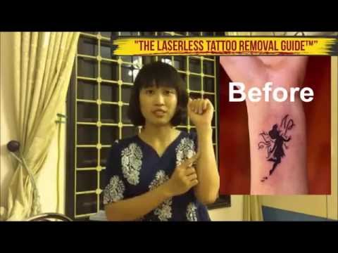download lagu mp3 mp4 Laserless Tattoo Removal Guide, download lagu Laserless Tattoo Removal Guide gratis, unduh video klip Laserless Tattoo Removal Guide