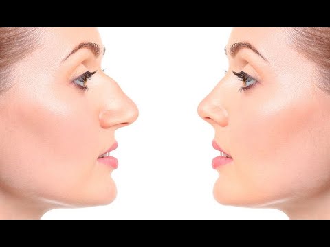 How is the swelling for thick skin for a rhinoplasty procedure?