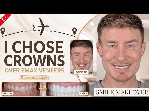 My Full Mouth Zirconium Smile Makeover in Istanbul