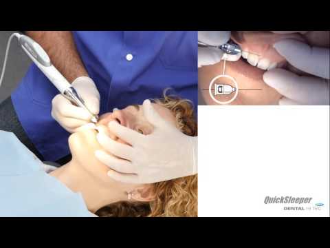 Posizioni e Utilizzo Quicksleeper