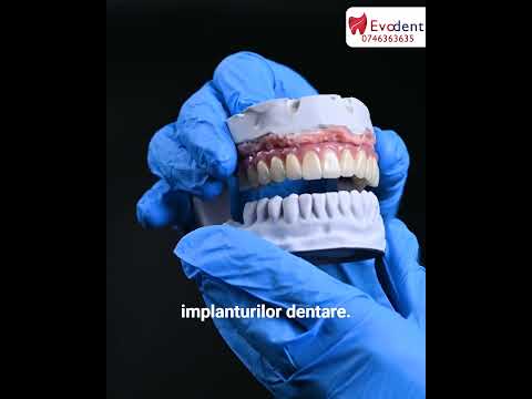 Pot beneficia de implanturi daca sunt în vârstă?