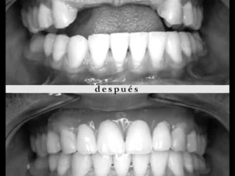Pierre Fauchard por Cesar Coronado
