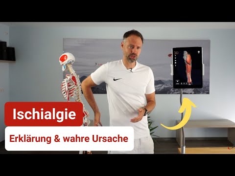 Ischialgie - Der wahre Grund für Deine Ischiasschmerzen ❌