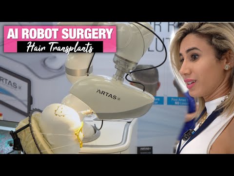 Doctor Explains Precise Hair Transplants with ARTAS Robotics