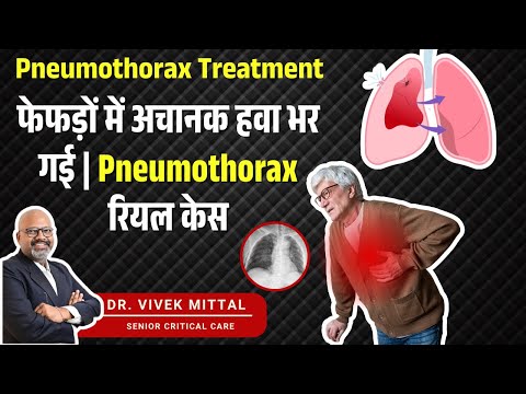 सीने में अचानक दर्द और सांस रुकने की नौबत | Pneumothorax Treatment
