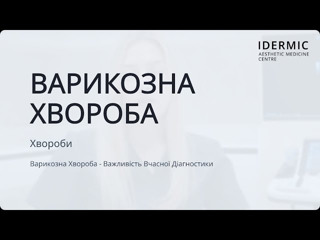 Варикозна Хвороба – Важливість Вчасної Діагностики – Центр IDERMIC Варикозна Хвороба – Важливість Вчасної Діагностики – Центр IDERMIC