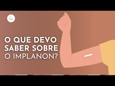 Implanon: Tudo O Que Você Precisa Saber | Dra. Camila Cambiaghi | Ginecologista