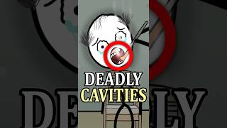 Cavities Could Be Deadly 🦷😰 #didyouknow #medieval #facts #history #medievalhistory