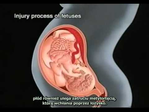 Choroba z Minamaty - zachować tą tragedię w pamięci - napisy  PL