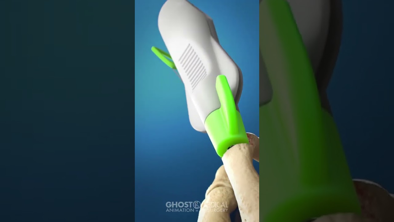 Marcos Michell Garcia Herrera-2