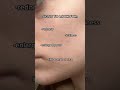 Skin Barrier 101