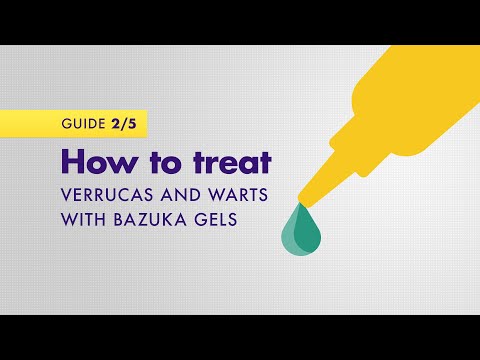 How to treat verrucas and warts with Bazuka gels