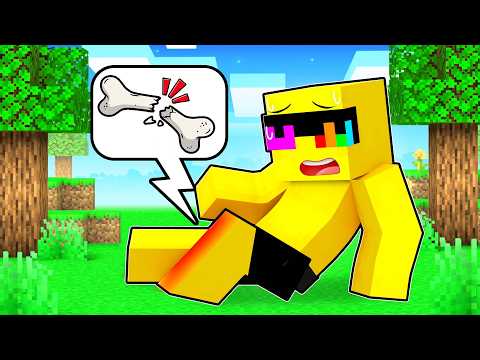 Sunny BROKE HIS LEG in Minecraft!