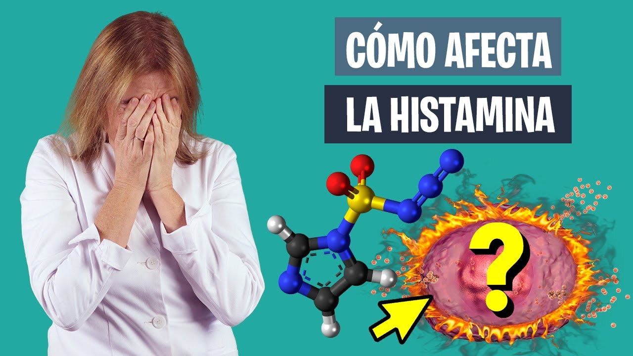 INTOLERANCIA a la HISTAMINA y su EFECT0 en el DEPORTE | Alergia al deporte | Nutrición deportiva