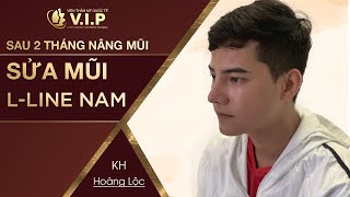 SỬA MŨI L LINE NAM - Lôi cuốn đầy nam tình cho phái mạnh