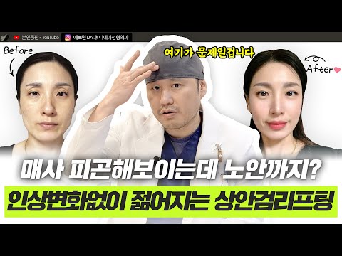 자연스러운 중년눈성형, 이것만 알면 성공합니다ㅣ디에이성형외과