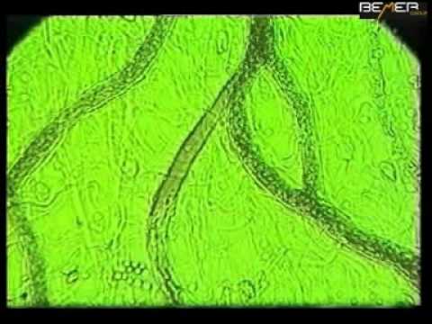 Valós idejű felvétel a kapilláris keringés helyreállításától - BEMER terápia