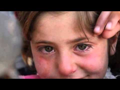 syria tragedy. children need help