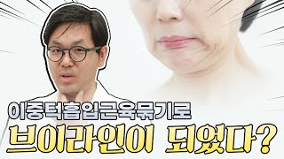 지긋지긋한 이중턱 이제 안녕..???? #아이루미성형외과