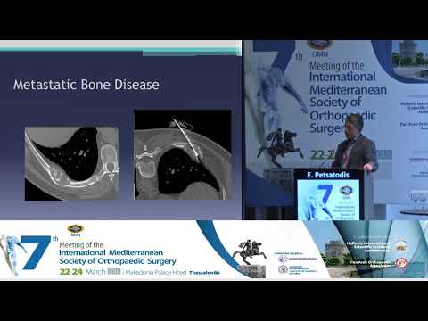 Petsatodis E - Current concepts in treatment of musculoskeletal tumors