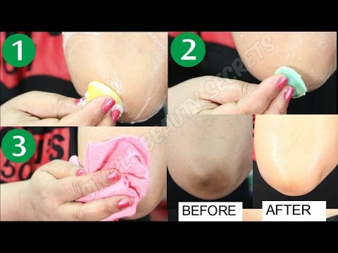 Skin Whitening For Dark Knees & Dark Elbows (LIVE RESULTS) By Simple Beauty Secrets Video