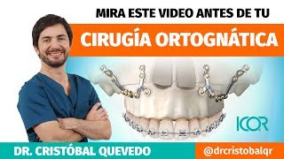 Cirugía Ortognática - Todo lo que necesitas saber [Antes y después de operarte]