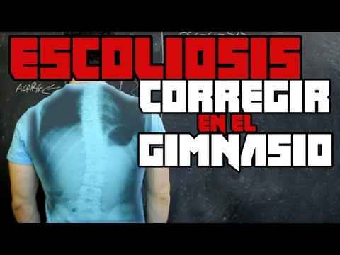 Asedio de vídeo columna cervical Cuando se recomienda la artritis de la articulación de la rodilla izquierda en el periodo 1